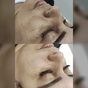 Limpeza de Manchas 2