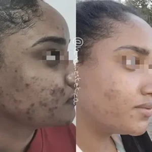 Limpeza de Manchas 1